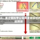 FDA：波士顿科学公司将更新召回的起搏器